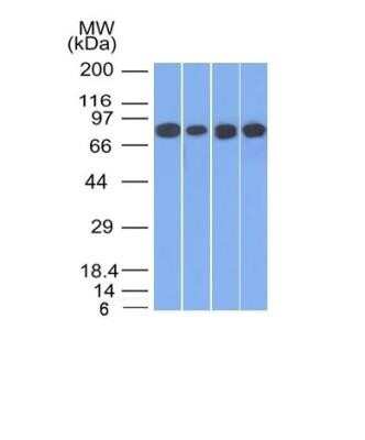 Western Blot: gamma Catenin Antibody ([11E4])Azide and BSA Free [NBP2-54528]