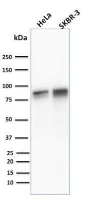 Western Blot: gamma Catenin Antibody ([11E4])Azide and BSA Free [NBP2-54528]