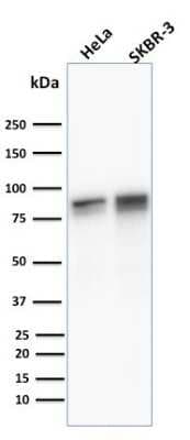 Western Blot: gamma Catenin Antibody ([11E4]) [NBP2-53306]