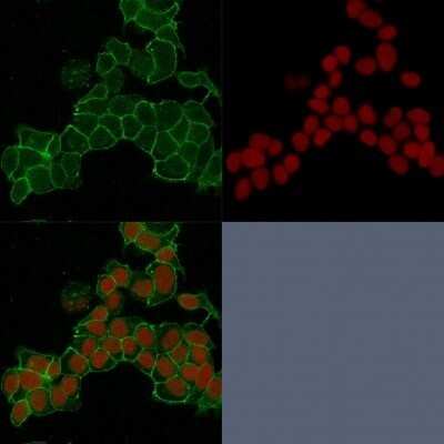 Immunocytochemistry/ Immunofluorescence: gamma Catenin Antibody (15F11) - Azide and BSA Free [NBP2-54527]