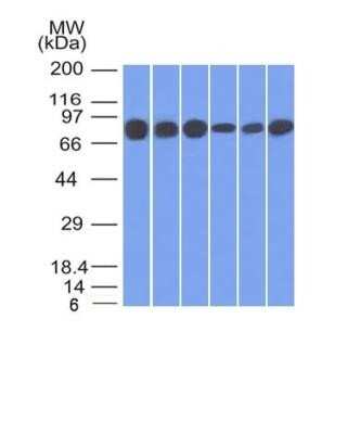 Western Blot: gamma Catenin Antibody (15F11)Azide and BSA Free [NBP2-54527]