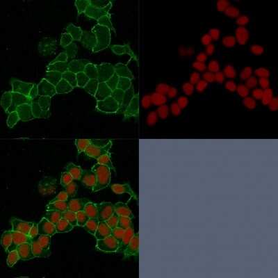 Immunocytochemistry/ Immunofluorescence: gamma Catenin Antibody (15F11) [NBP2-53325]