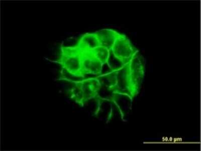 Immunocytochemistry/ Immunofluorescence: gamma Catenin Antibody (2G9) [H00003728-M01]