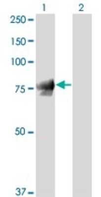 Western Blot: gamma Catenin Antibody (2G9) [H00003728-M01]
