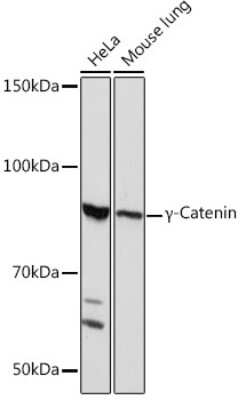 Western Blot: gamma Catenin Antibody (9O2K8) [NBP3-16344]