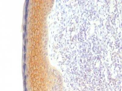 Immunohistochemistry: gamma Catenin Antibody (CTNG/1483) [NBP2-53165]