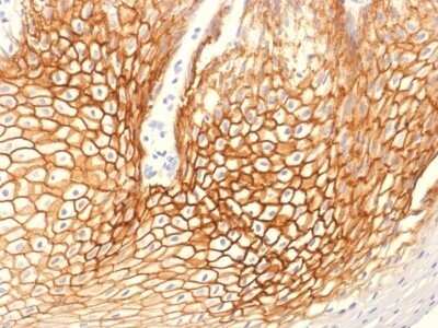Immunohistochemistry-Paraffin: gamma Catenin Antibody (CTNG/1664) - Azide and BSA Free [NBP2-54524]