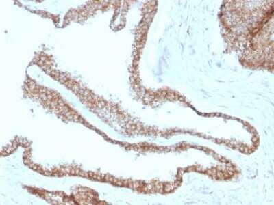Immunohistochemistry-Paraffin: gamma Catenin Antibody (CTNG/1664) [NBP2-53172]