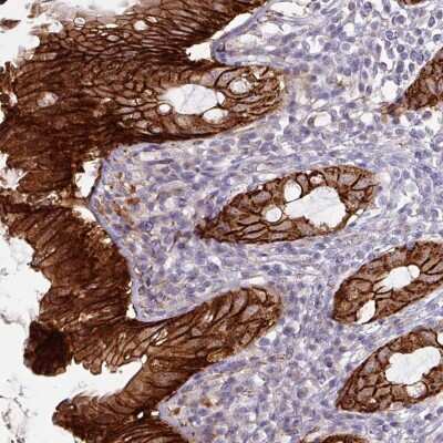 Immunohistochemistry-Paraffin: gamma Catenin Antibody [NBP2-33965]