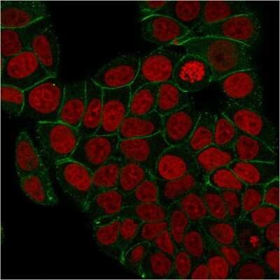 Immunocytochemistry/ Immunofluorescence: gamma Catenin Antibody (rCTNG/1664) - Azide and BSA Free [NBP3-08469]