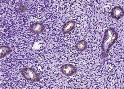 Immunohistochemistry-Paraffin: gamma-Glutamylcyclotransferase/CRF21/GGCT Antibody [NBP3-12540]
