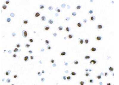 Immunocytochemistry/ Immunofluorescence: Histone H2AX [p Ser139] Antibody (BLR053F) [NBP3-14678]