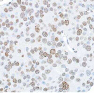 Immunohistochemistry-Paraffin: Histone H2AX [p Ser139] Antibody (BLR053F) [NBP3-14678]