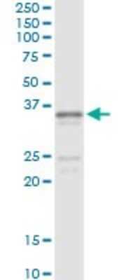 Immunoprecipitation: gamma Sarcoglycan Antibody (3C5) [H00006445-M02]
