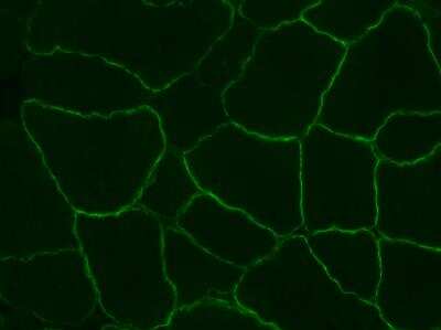 Immunohistochemistry-Frozen: gamma Sarcoglycan Antibody [NBP1-59744]