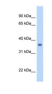 Western Blot: gamma Sarcoglycan Antibody [NBP1-59744]