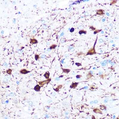 Immunohistochemistry-Paraffin: gamma-Synuclein Antibody (4A0F4) [NBP3-16144]