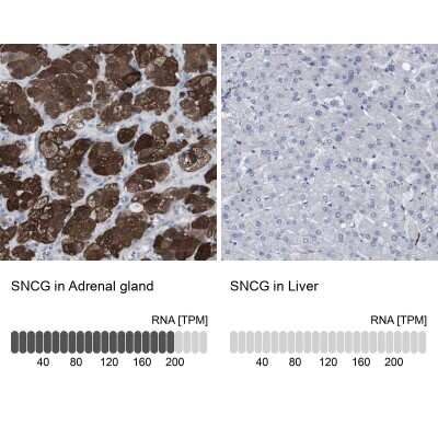 Immunohistochemistry-Paraffin: gamma-Synuclein Antibody [NBP1-89996]