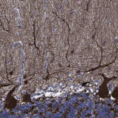 Immunohistochemistry-Paraffin: gamma-Synuclein Antibody [NBP1-89996]