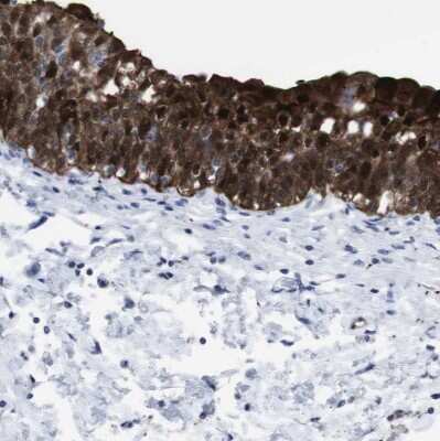 Immunohistochemistry-Paraffin: gamma-Synuclein Antibody [NBP1-89996]