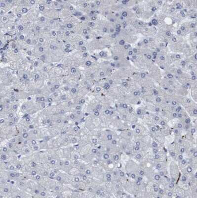 Immunohistochemistry-Paraffin: gamma-Synuclein Antibody [NBP1-89996]