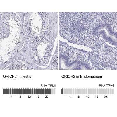 Immunohistochemistry-Paraffin: glutamine rich 2 Antibody [NBP2-56731]