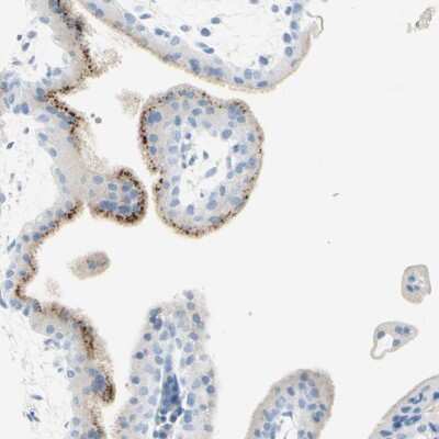 Immunohistochemistry-Paraffin: gp130/CD130 Antibody [NBP1-88138]