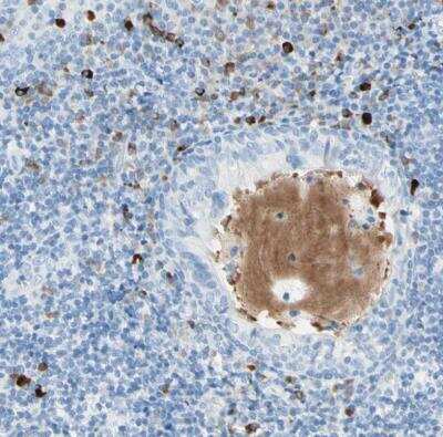 Immunohistochemistry-Paraffin: gp130/CD130 Antibody [NBP1-88138]