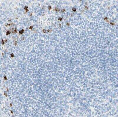 Immunohistochemistry-Paraffin: gp130/CD130 Antibody [NBP1-88138]