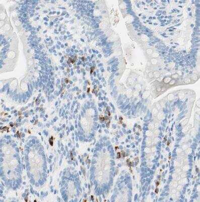 Immunohistochemistry-Paraffin: gp130/CD130 Antibody [NBP1-88138]