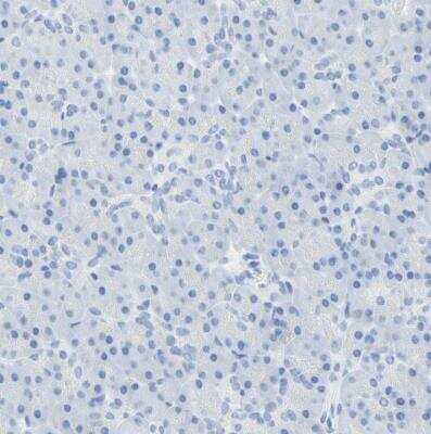 Immunohistochemistry-Paraffin: gp130/CD130 Antibody [NBP1-88138]