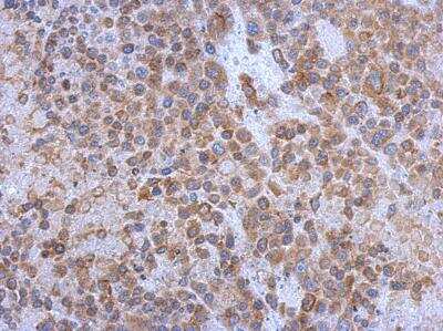Immunohistochemistry-Paraffin: gp130/CD130 Antibody [NBP2-15776]