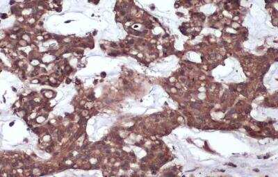 Immunohistochemistry-Paraffin: gp130/CD130 Antibody [NBP2-15776]