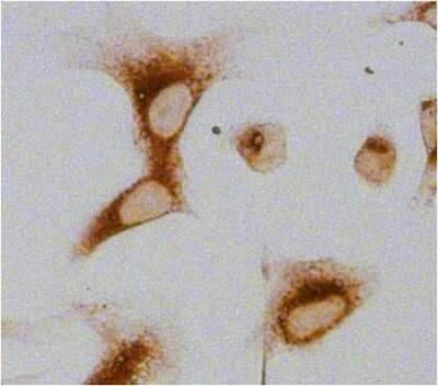 Immunohistochemistry-Paraffin: gp96/HSP90B1/GRP94 Antibody (9G10) [NB300-619]
