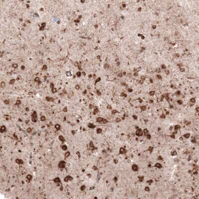 Immunohistochemistry-Paraffin: gp96/HSP90B1/GRP94 Antibody (CL2647) [NBP2-42379]