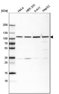 Western Blot: gp96/HSP90B1/GRP94 Antibody (CL2647) [NBP2-42379]