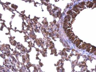 Immunohistochemistry: gp96/HSP90B1/GRP94 Antibody [NBP1-32118]