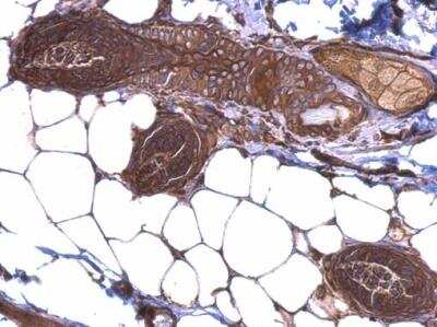 Immunohistochemistry-Paraffin: gp96/HSP90B1/GRP94 Antibody [NBP1-32118]