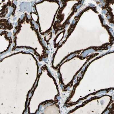 Immunohistochemistry-Paraffin: gp96/HSP90B1/GRP94 Antibody [NBP1-81802]