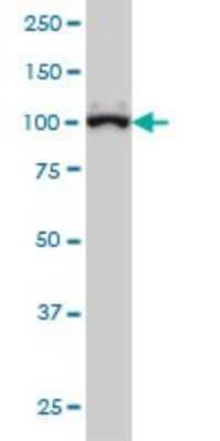 Western Blot: gtf3c3 Antibody (2D8) [H00009330-M01]