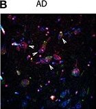 Jagged 1 Antibody (1E12)