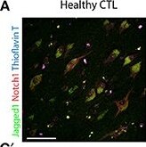 Jagged 1 Antibody (1E12)