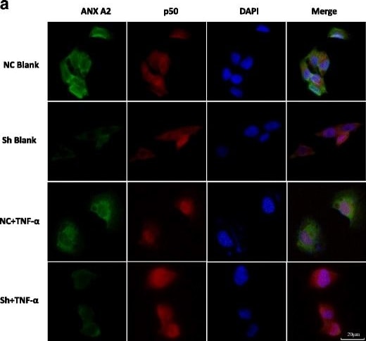 Annexin A2 Antibody (1G7)