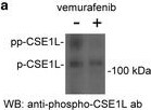 CSE1L/CAS/Exportin-2 Antibody (3D8)