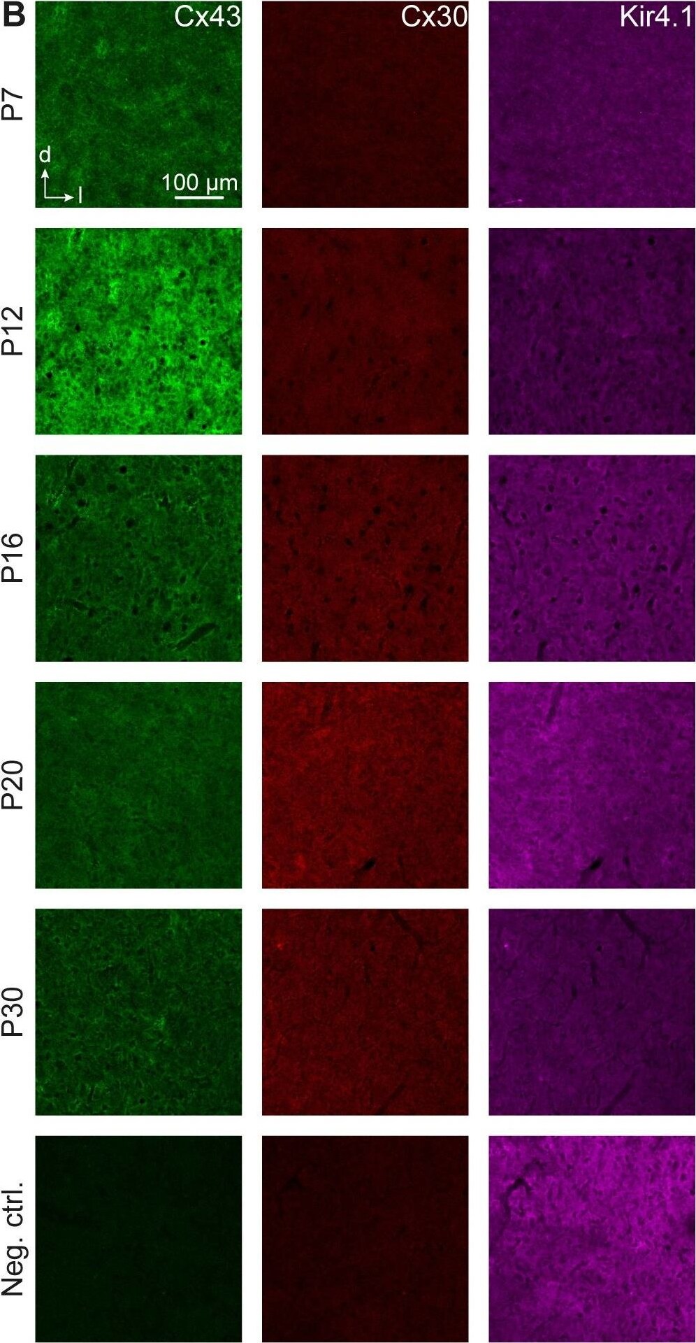 KCNJ10 Antibody (1C11)