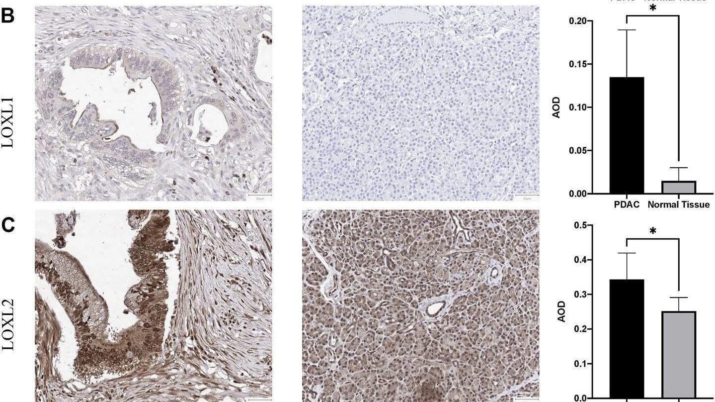 LOXL1 Antibody - Azide and BSA Free