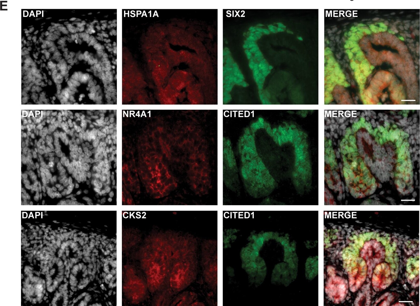CITED1 Antibody (5H6)
