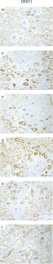 NRAMP2/SLC11A2/DMT1 Antibody (4C6)
