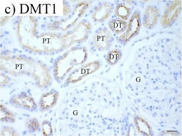 NRAMP2/SLC11A2/DMT1 Antibody (4C6)