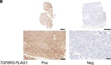 PLAG1 Antibody (3B7)